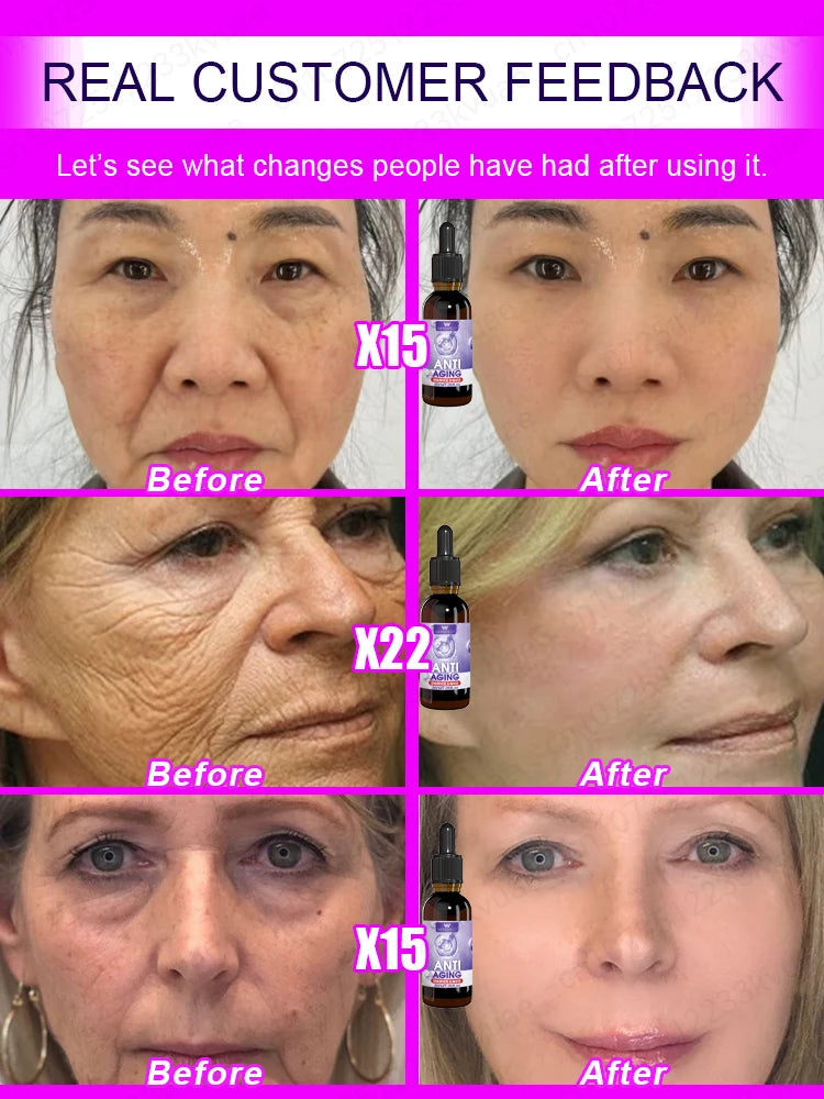 Tratamiento Intensivo Antiarrugas – Efecto Rejuvenecedor y Firmeza Total (Luce 20 años más joven)